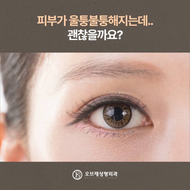 Postoperative Care After Double Eyelid Surgery: Precautions for a Faster Recovery image 9