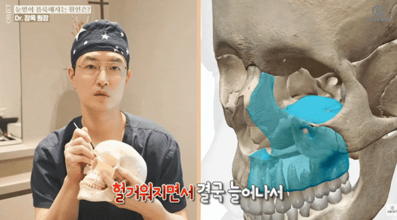 Cause of Under-Eye Fat? Read Dr. Jang Wook’s <Key Summary> First! image 5