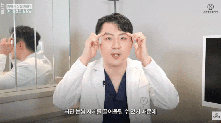 Forehead Lift Effect? For Drooping Eyelids, Director Kim Hyun-jo’s <3> Recommendations! image 7