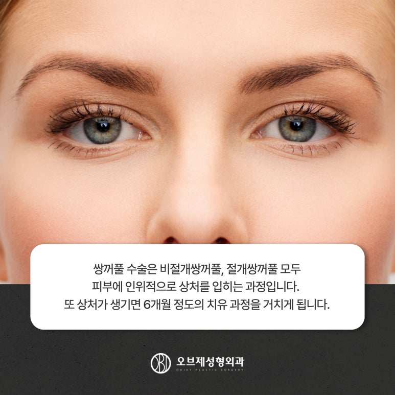 Postoperative Care After Double Eyelid Surgery: Precautions for a Faster Recovery image 10