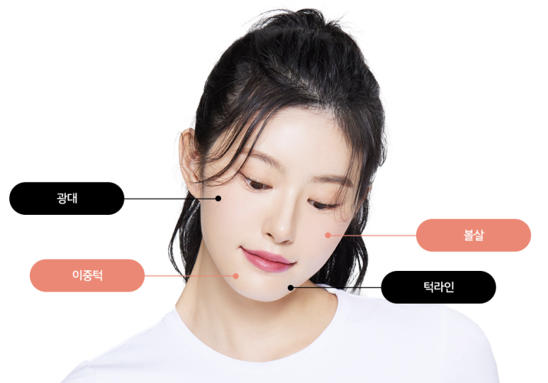 윤곽주사 효과 남다른 강남오브제성형외과 관련 이미지 6