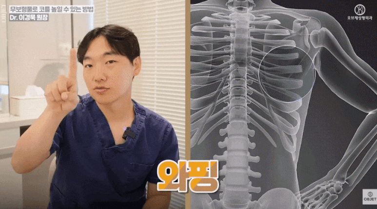 무보형물 코수술 ○○에는 비추천? - 이경묵 원장님 정리 관련 이미지 5