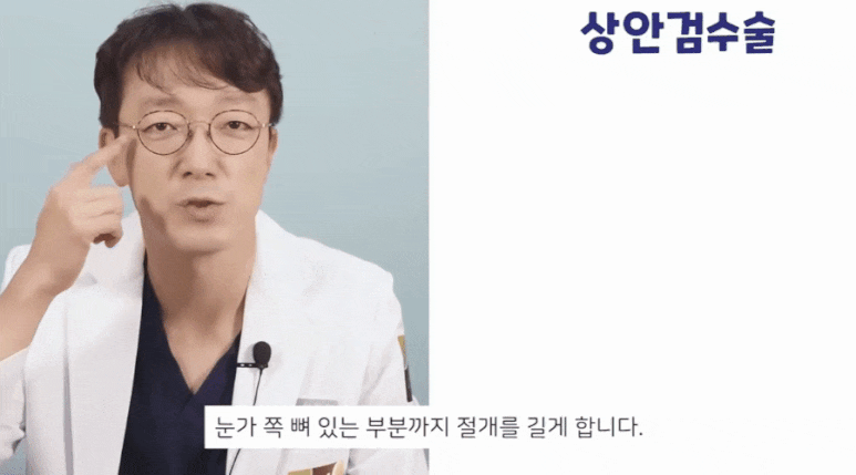 상안검 뜻? 신종인 원장님이 <핵심>만 정리해 드립니다! 관련 이미지 5