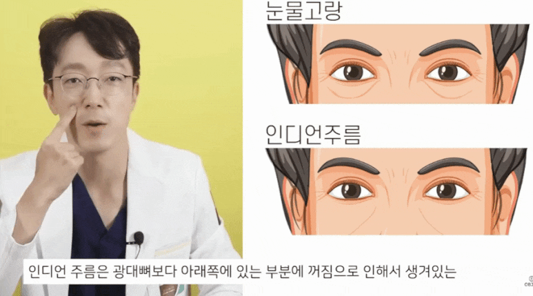 Lower Eyelid Fat Repositioning Swelling? Dr. Shin Jong-in Talks About the Real <Concerns> image 8
