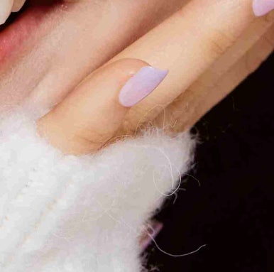Why Dark Circle Treatment in Gangnam Requires Careful Consideration image 15