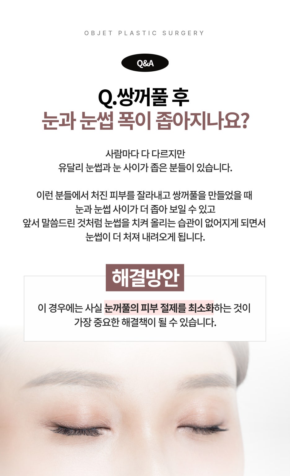 Questions About Double Eyelid Surgery in Gangnam image 6