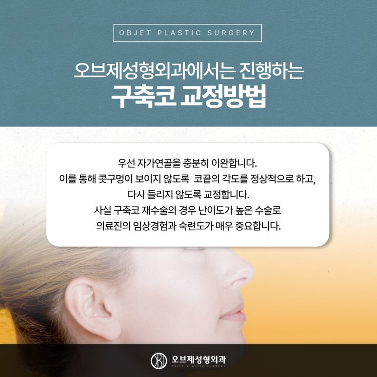 코재수술 언제해야 하나요? 관련 이미지 7