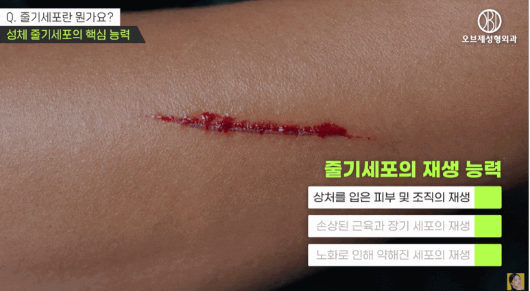 What Are the Types and Effects of Stem Cell Injections? I’ll Explain It Simply (Answer from a Plastic Surgeon) image 8