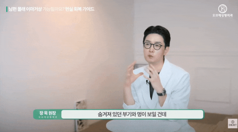 Can the Recovery Period for a Forehead Lift Be Just One Week? Director Jang Wook Answers! image 5