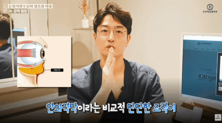 Under-Eye Fat Repositioning in Your 20s: Recommended If You Have These <Characteristics> │ Summary by Director Jang Wook image 3