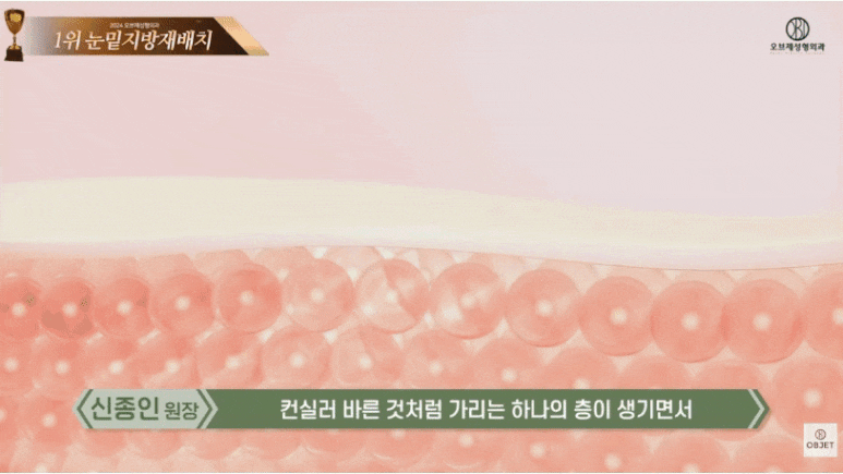 강남 눈밑지방재배치 신종인 원장님이 밝힌 오브제만의 비결! 관련 이미지 8
