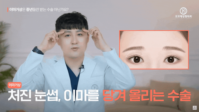 Forehead Lift in Your 20s: Why MZ Is Choosing It Instead of Double Eyelid Surgery image 6