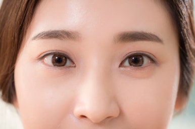 Precautions After Suture-Based Double Eyelid Surgery image 2