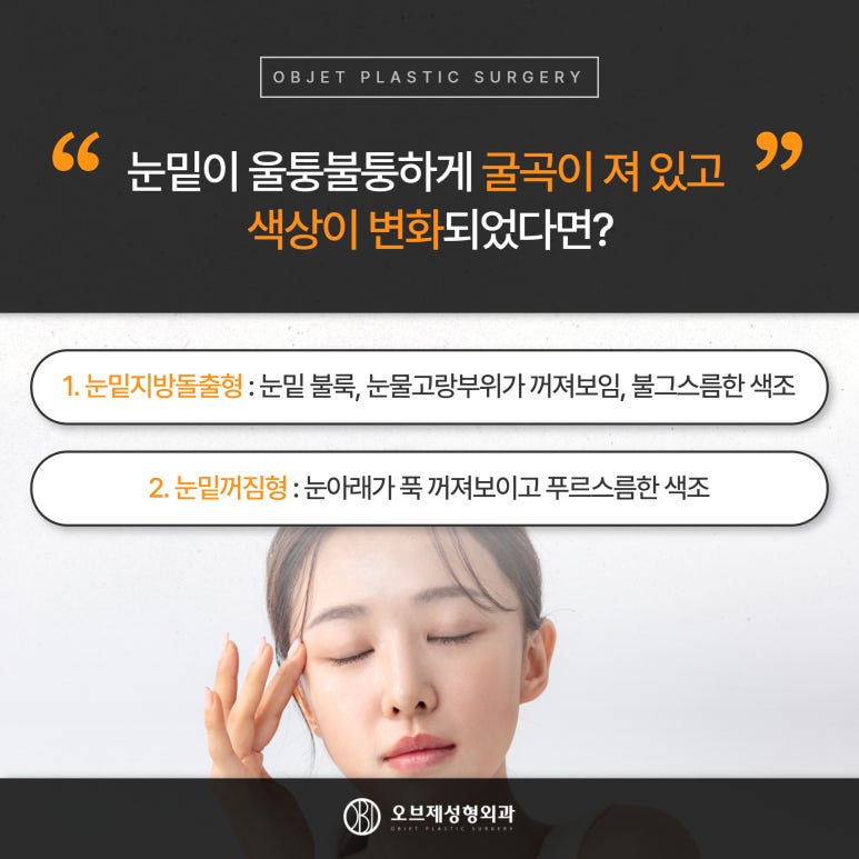 눈밑꺼짐과 불룩해지는 이유 관련 이미지 2