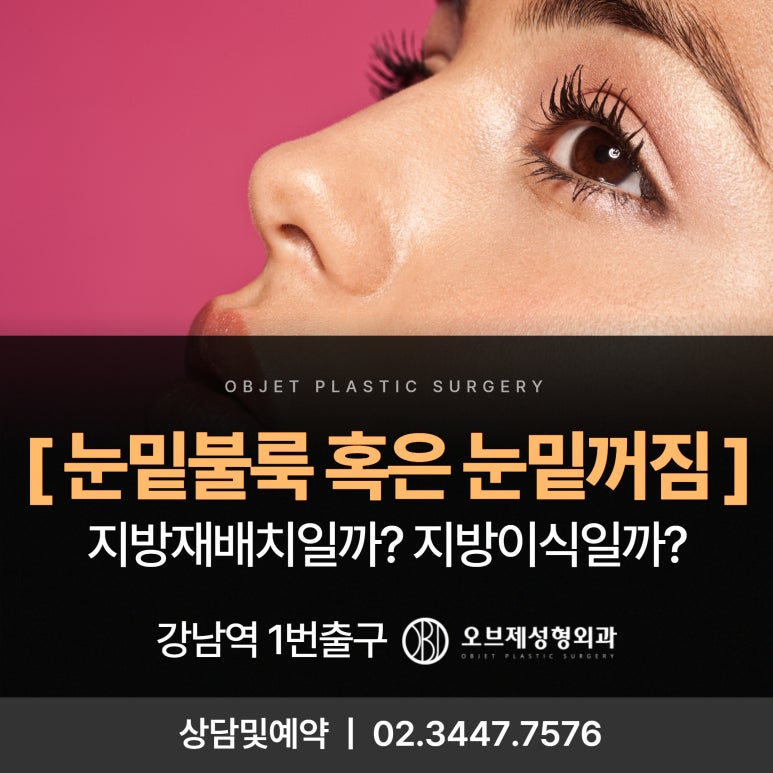 눈밑꺼짐과 불룩해지는 이유 관련 이미지 1