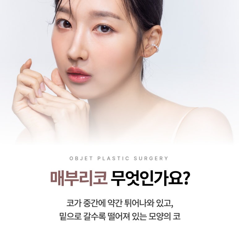 Causes of Hump Nose Rhinoplasty image 2