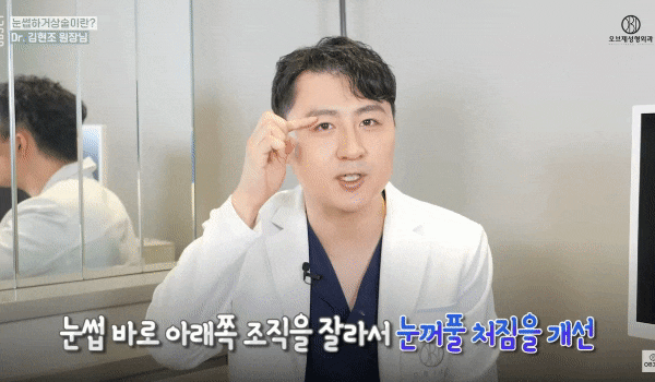 중년 상안검은 쌍꺼풀 무조건? 김현조 원장님의 오해 타파! 관련 이미지 6