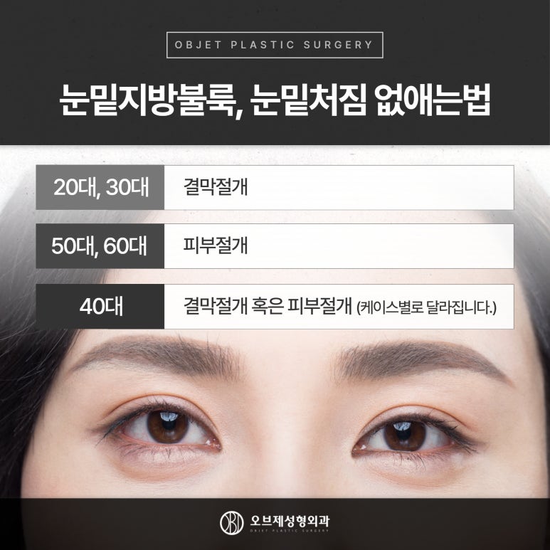 오브제성형외과 신종인 원장님, 눈밑성형 1초만에 결정 관련 이미지 9