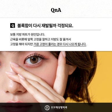눈밑 뒤집힘, 애교살, 흉터 등 하안검수술 부작용 관련 이미지 11