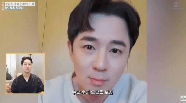눈밑지방재배치 연예인 TOP 5! 장욱 원장님이 분석해 드립니다 관련 이미지 7