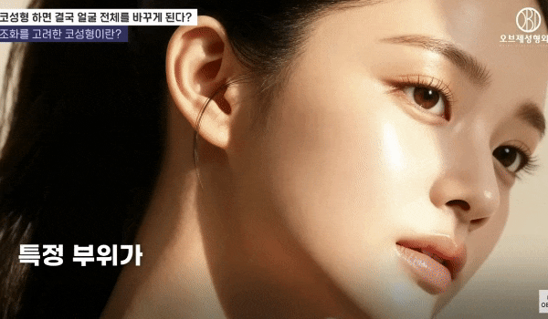 Why Don’t the Tips of the Nose Droop at Well-Known Rhinoplasty Clinics? The Secret Revealed! image 12