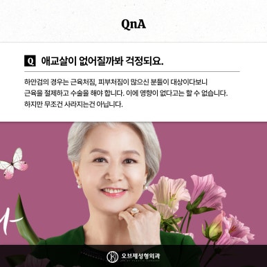 눈밑 뒤집힘, 애교살, 흉터 등 하안검수술 부작용 관련 이미지 13
