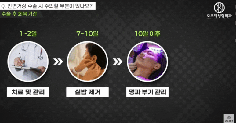 안면거상 전후, 자연스러움의 차이는 &lsquo;이것&rsquo;에서 결정됩니다 관련 이미지 10