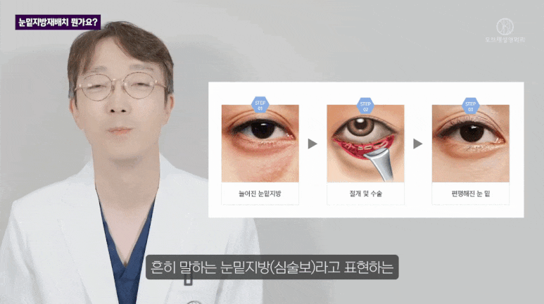 눈밑 지방재배치 수술, 가장 많이 들은 질문 TOP2는? 관련 이미지 3