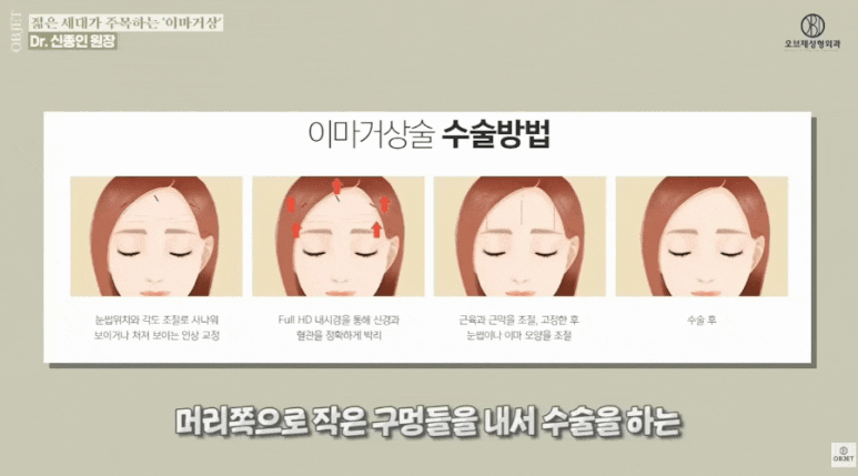 이마거상후기? 신종인 원장님이 밝히는 <숨은 효과> 관련 이미지 4