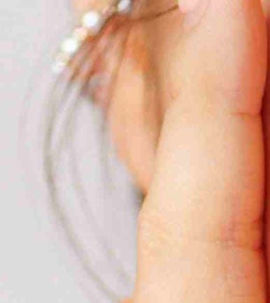 The Difference Between Upper Blepharoplasty and Incisional Double Eyelid Surgery #Director Kim Hyun-jo image 11
