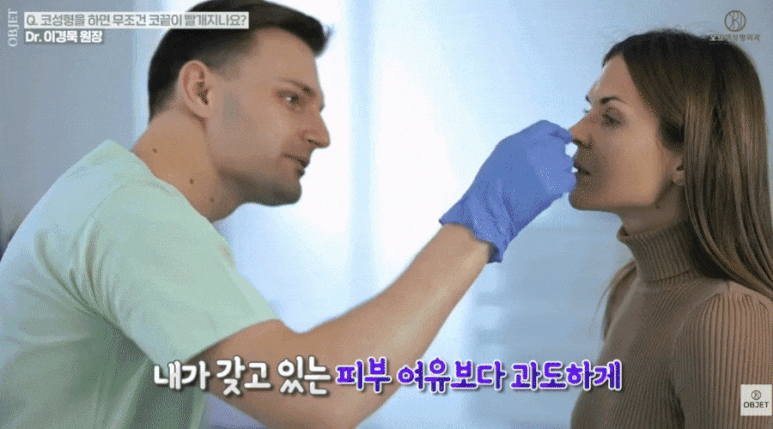 코수술 코끝 빨개짐 피하는 법? 이경묵 원장님의 <답변> 관련 이미지 7
