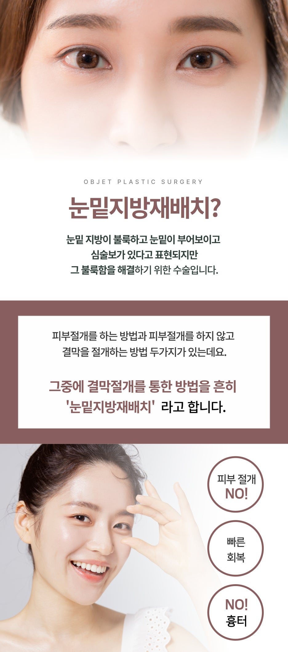 Gangnam Under-Eye Surgery: Which Procedure Is Right for Me? image 3