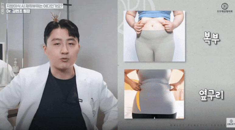 Eyelid Fat Grafting: Fat Retention Rate and Results? Dr. Kim Hyun-jo’s <Q&A> image 7