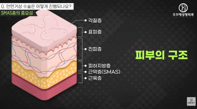 안면거상 전후, 자연스러움의 차이는 &lsquo;이것&rsquo;에서 결정됩니다 관련 이미지 5