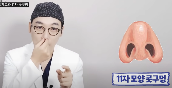코성형 콧구멍 110V 빨래집게 코 #이경묵원장님 관련 이미지 4