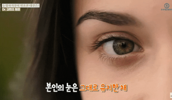 Drooping Eyelids and Sagging Upper Eyelids image 2