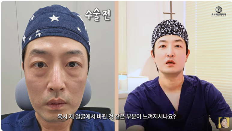 A Review of Dr. Jang Uk’s Dual Lower Blepharoplasty at Obje Plastic Surgery image 2