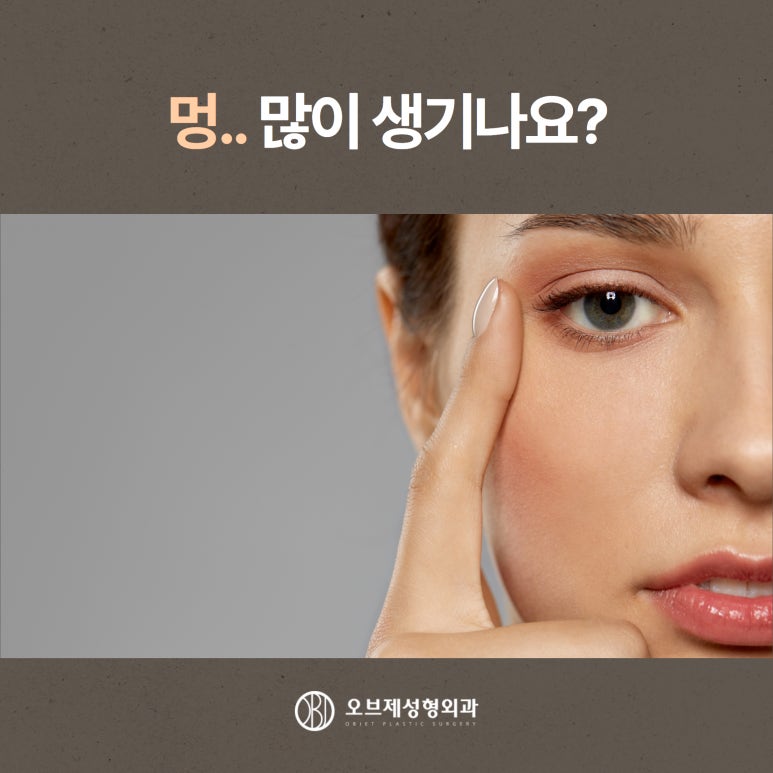 Postoperative Care After Double Eyelid Surgery: Precautions for a Faster Recovery image 5