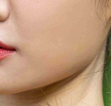 강남쌍수 함께 하면 좋은 수술 오브제성형외과 관련 이미지 14