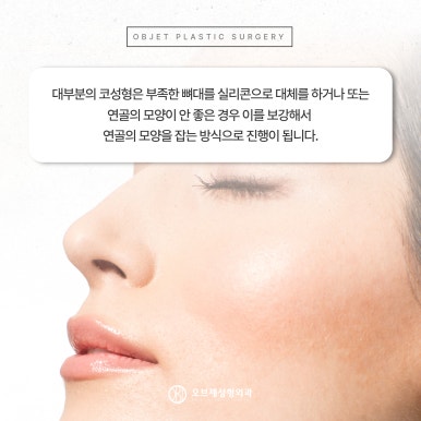 코성형보형물 실리콘or연골 나에게 맞는 방법은? 관련 이미지 7