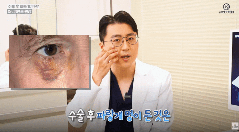 눈밑지 회복기간 휴가 써야겠죠? 김현조 원장님 답변! 관련 이미지 5