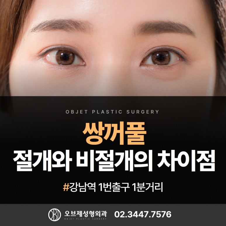 절개와 비절개 쌍꺼풀 수술 , 어떤 것이 좋을까? 관련 이미지 1