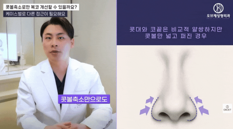 Nasal Ala Reduction Surgery: Selection Criteria as Explained by Director Park Si-hyun image 3