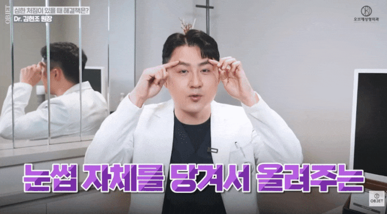 상안검 수술후기만 보지 마세요! 김현조 원장님 <가이드> 관련 이미지 4