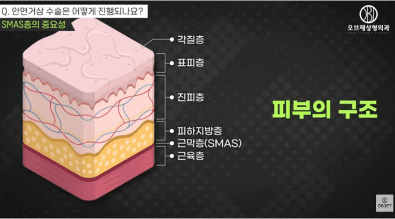 Three Key Points for Choosing a Facelift Clinic, Organized by Director Shin Jong-in image 4