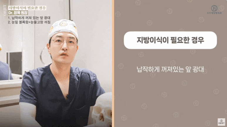 Would Fat Grafting with Under-Eye Fat Repositioning Be Better? Facial Types That Need Fat Grafting! (Explained by a Plastic Surgery Specialist) image 4
