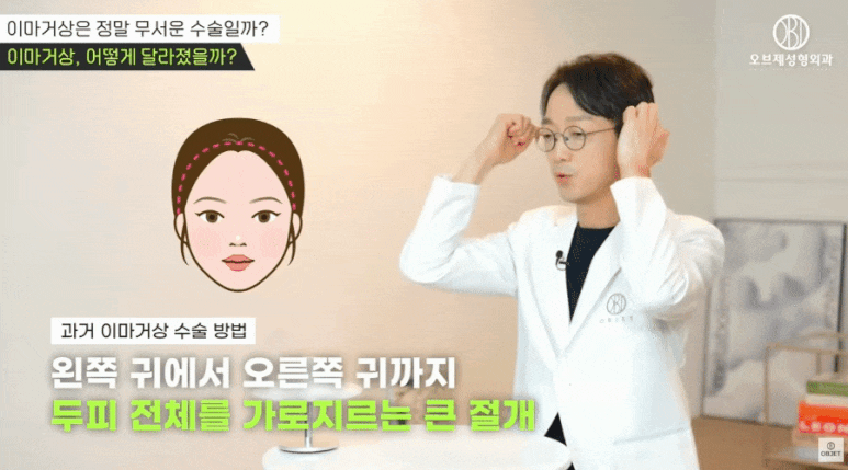 내시경 이마거상 MZ가 찾는 이유? 신종인 원장님 <정리> 관련 이미지 5