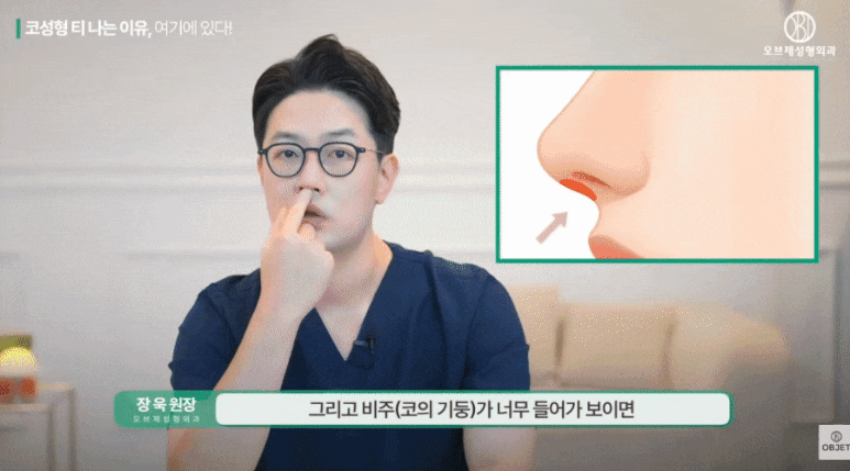 코수술 콧구멍 짝짝이되는 거 아니겠죠? 장욱 원장님 답변! 관련 이미지 5