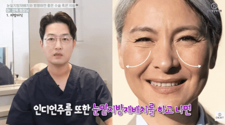 눈밑지방재배치수술후 시술? 장욱 원장님이 추천하는 <세 가지> 관련 이미지 4