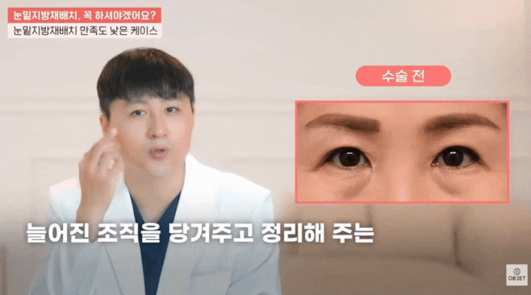 Can Under-Eye Dark Circles Be Resolved? Director Kim Hyun-jo <Answer> image 6